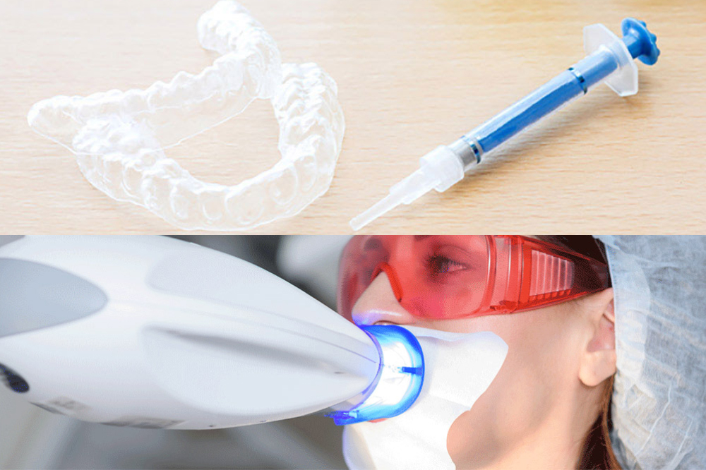 デュアルホワイトニング